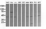 MAP2K1 Antibody in Western Blot (WB)