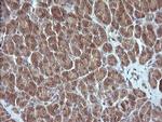 MAP2K3 Antibody in Immunohistochemistry (Paraffin) (IHC (P))