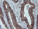 MAP2K3 Antibody in Immunohistochemistry (Paraffin) (IHC (P))