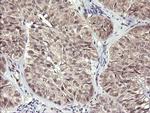 MAP2K3 Antibody in Immunohistochemistry (Paraffin) (IHC (P))