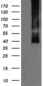 MAP2K3 Antibody in Western Blot (WB)