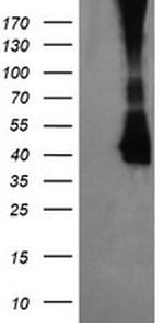 MAP2K3 Antibody in Western Blot (WB)