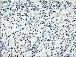 MAP2K4 Antibody in Immunohistochemistry (Paraffin) (IHC (P))