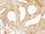 MAP4 Antibody in Immunohistochemistry (IHC)