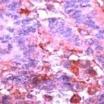 ERK1 Antibody in Immunohistochemistry (IHC)