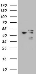 MAPKAPK5 Antibody in Western Blot (WB)