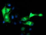 EB2 (MAPRE2) Antibody in Immunocytochemistry (ICC/IF)