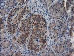 EB2 (MAPRE2) Antibody in Immunohistochemistry (Paraffin) (IHC (P))