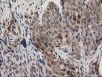 EB2 (MAPRE2) Antibody in Immunohistochemistry (Paraffin) (IHC (P))