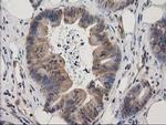 EB2 (MAPRE2) Antibody in Immunohistochemistry (Paraffin) (IHC (P))