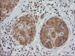 EB2 (MAPRE2) Antibody in Immunohistochemistry (Paraffin) (IHC (P))