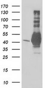 EB2 (MAPRE2) Antibody in Western Blot (WB)