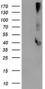 EB2 (MAPRE2) Antibody in Western Blot (WB)