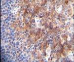 MARCO Antibody in Immunohistochemistry (IHC)