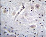 MARK1 Antibody in Immunohistochemistry (IHC)