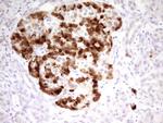 MARK3 Antibody in Immunohistochemistry (Paraffin) (IHC (P))