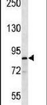 MARK1 Antibody in Western Blot (WB)