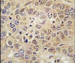 MARS Antibody in Immunohistochemistry (IHC)