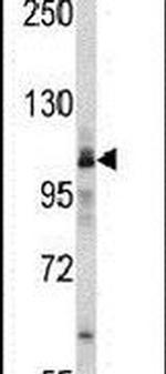 MARS Antibody in Western Blot (WB)