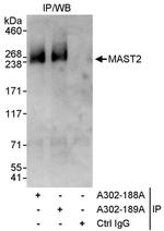 MAST2 Antibody in Immunoprecipitation (IP)