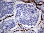 MCAM Antibody in Immunohistochemistry (Paraffin) (IHC (P))