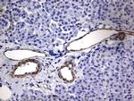 MCAM Antibody in Immunohistochemistry (Paraffin) (IHC (P))