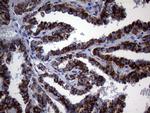 MCEE Antibody in Immunohistochemistry (Paraffin) (IHC (P))