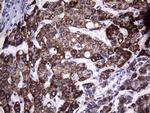 MCEE Antibody in Immunohistochemistry (Paraffin) (IHC (P))