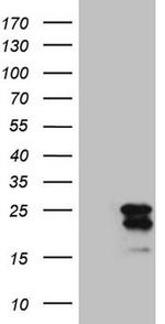 MCEE Antibody in Western Blot (WB)