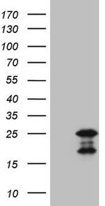 MCEE Antibody in Western Blot (WB)