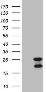 MCEE Antibody in Western Blot (WB)