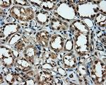 MCL1 Antibody in Immunohistochemistry (Paraffin) (IHC (P))