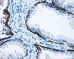 MCL1 Antibody in Immunohistochemistry (Paraffin) (IHC (P))