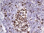 MCM2 Antibody in Immunohistochemistry (Paraffin) (IHC (P))