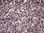 MCM2 Antibody in Immunohistochemistry (Paraffin) (IHC (P))