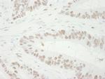 MCM3 Antibody in Immunohistochemistry (IHC)