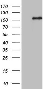 MCPH1 Antibody in Western Blot (WB)