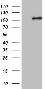 MCPH1 Antibody in Western Blot (WB)