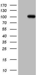 MCPH1 Antibody in Western Blot (WB)