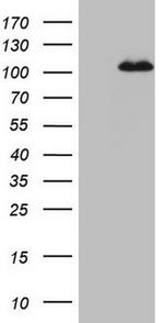 MCPH1 Antibody in Western Blot (WB)