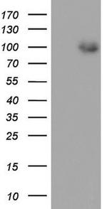 MDM2 Antibody in Western Blot (WB)