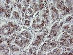 MDM4 Antibody in Immunohistochemistry (Paraffin) (IHC (P))