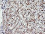 MDM4 Antibody in Immunohistochemistry (Paraffin) (IHC (P))