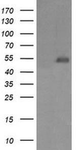 MDM4 Antibody in Western Blot (WB)