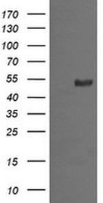 MDM4 Antibody in Western Blot (WB)
