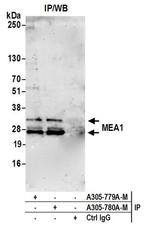 MEA1 Polyclonal Antibody (A305-779A-T)