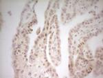 MED15 Antibody in Immunohistochemistry (Paraffin) (IHC (P))