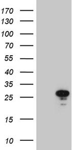 MED19 Antibody in Western Blot (WB)