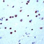 MEF2A Antibody in Immunohistochemistry (IHC)