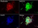 MEF2C Antibody in Immunocytochemistry (ICC/IF)